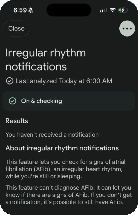 Irregular rhythm notifications screen showing On and checking and the time of the last analysis