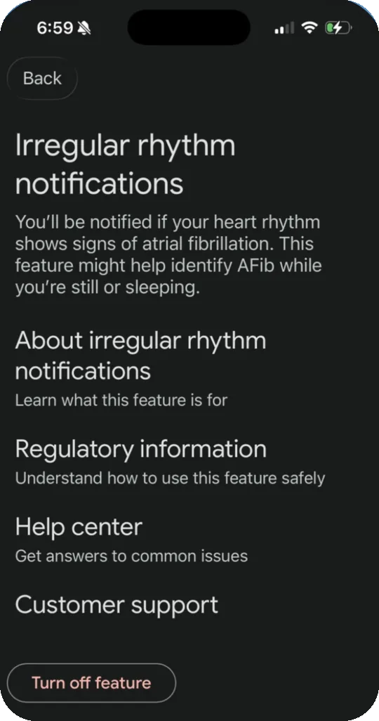 Irregular rhythm settings screen with Regulatory information and a Turn off feature button