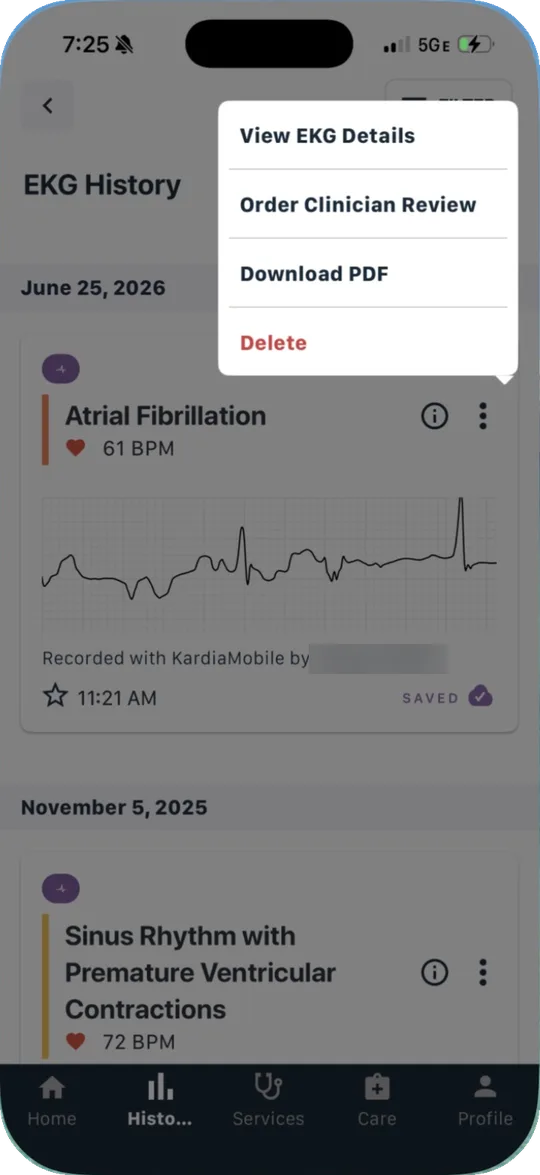 EKG History with the menu open showing View EKG Details, Order Clinician Review, Download PDF, and Delete