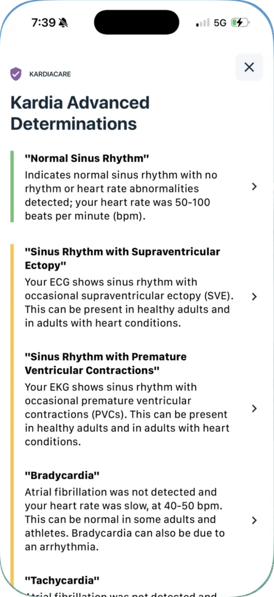Kardia results guide explaining Normal Sinus Rhythm, Sinus Rhythm with Supraventricular Ectopy, Sinus Rhythm with Premature Ventricular Contractions, and Bradycardia
