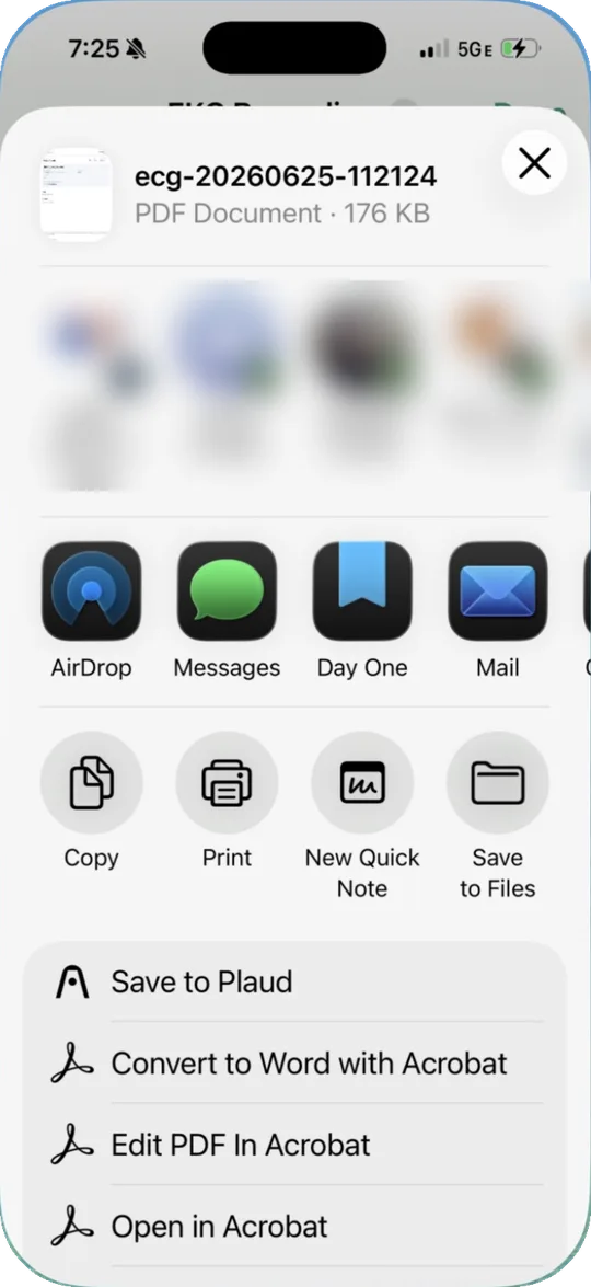 iPhone share sheet for the EKG PDF with AirDrop, Messages, Mail, Print, and Save to Files, with contacts blurred